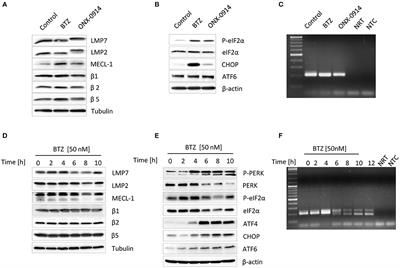 Molecular Insight Into the IRE1α-Mediated Type I Interferon Response Induced by Proteasome Impairment in Myeloid Cells of the Brain